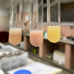 Evaluación integral de la dislipemia: armonización desde la petición médica al informe