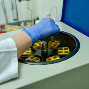 Taller de filtrado glomerular y creatinina: elegir método y garantizar calidad