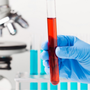 Elementos prácticos de líquidos de punción